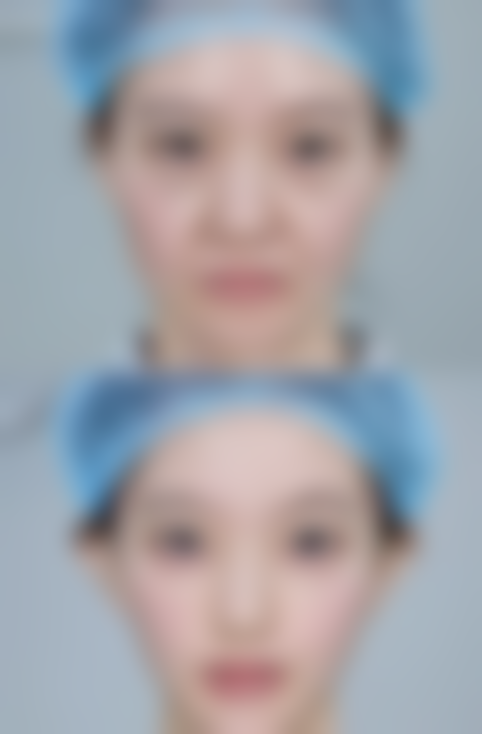 深圳艾薇感光整形医院价格表(仅供参考)