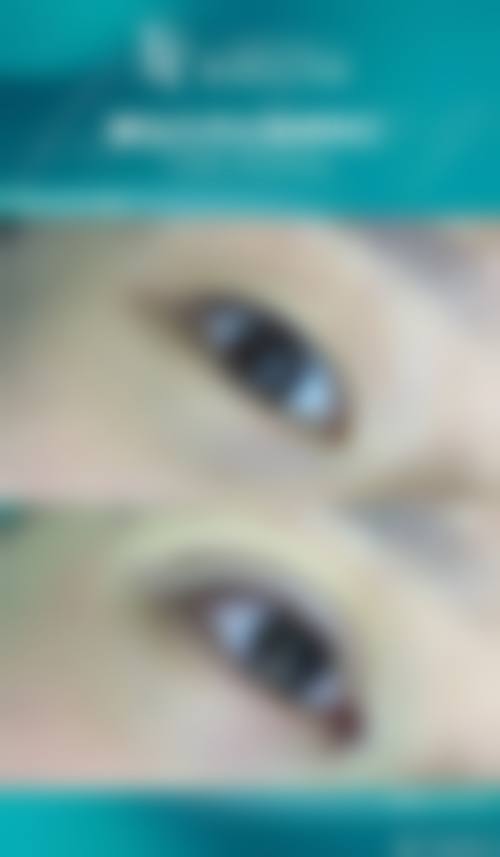 广州皙肤佳整形医院怎么预约？