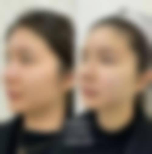 姜广霞患者评价