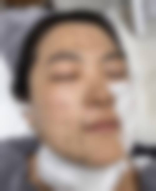 宜昌越龄整形医疗美容诊所实例参考