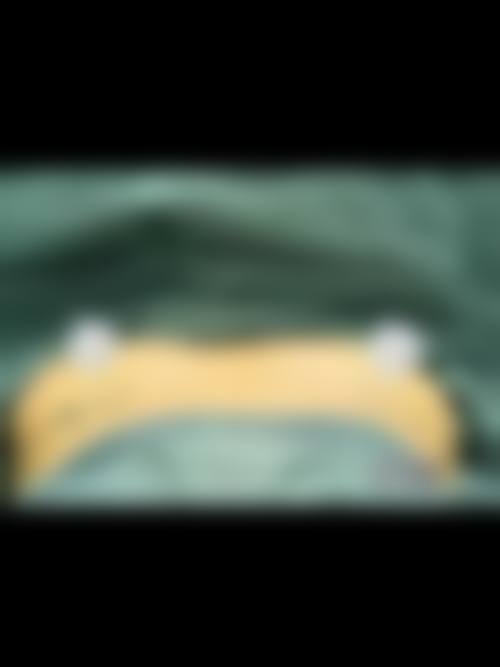 南昌二附医院整形美容科实例参考