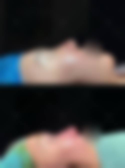 哈尔滨紫曦医疗美容门诊价格表（仅供参考）