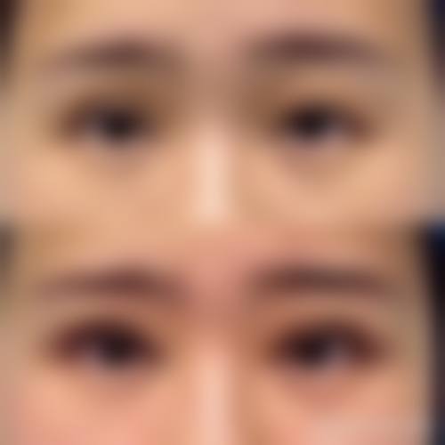 广州皙肤佳整形医院实例参考