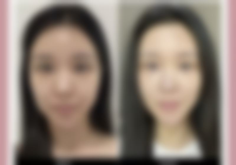 俞立英患者评价