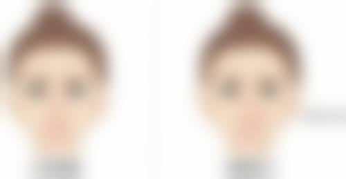 武汉兰致医疗美容实例参考