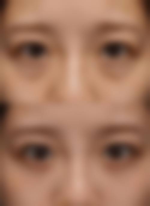 广州唯人昱美医疗美容诊所核心项目