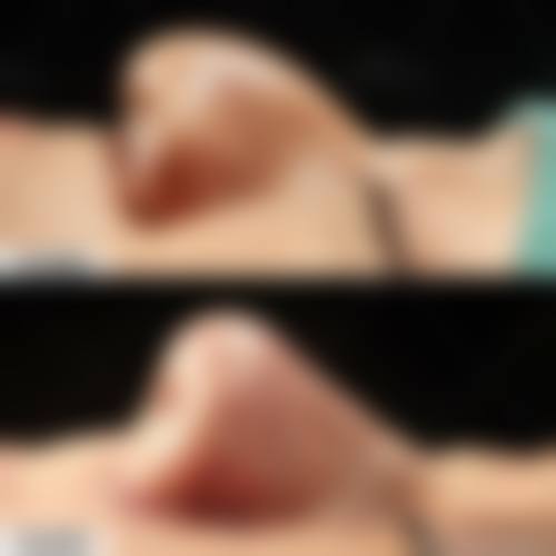 青岛缤悦容整形医疗美容门诊部价格表（仅供参考）