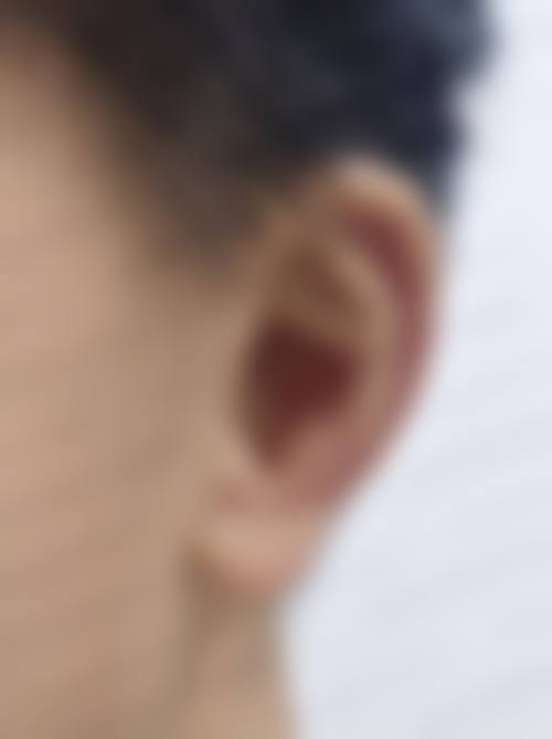 长沙艾泊医疗美容实例参考