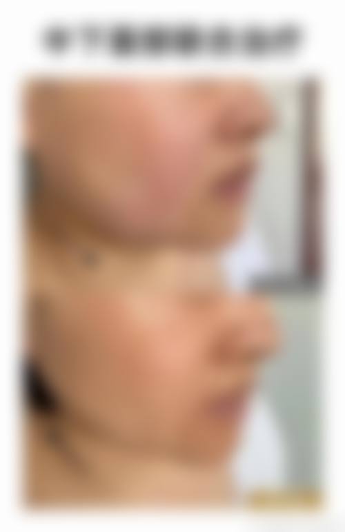 邵通昭阳美度整形医院怎么预约？