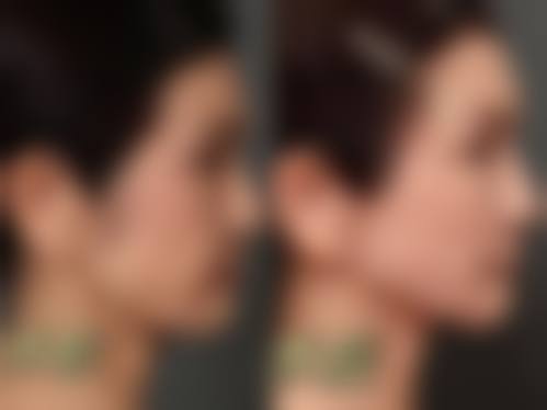 邵通昭阳美度整形医院实例参考