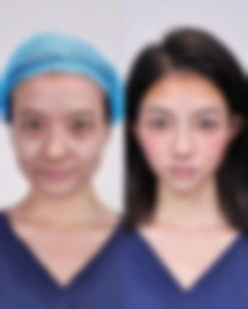 何升擅长项目列表