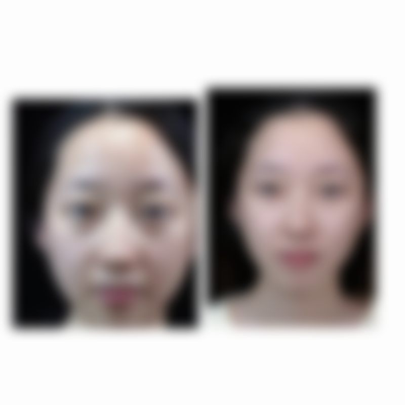 表参道Skin广岛实例参考