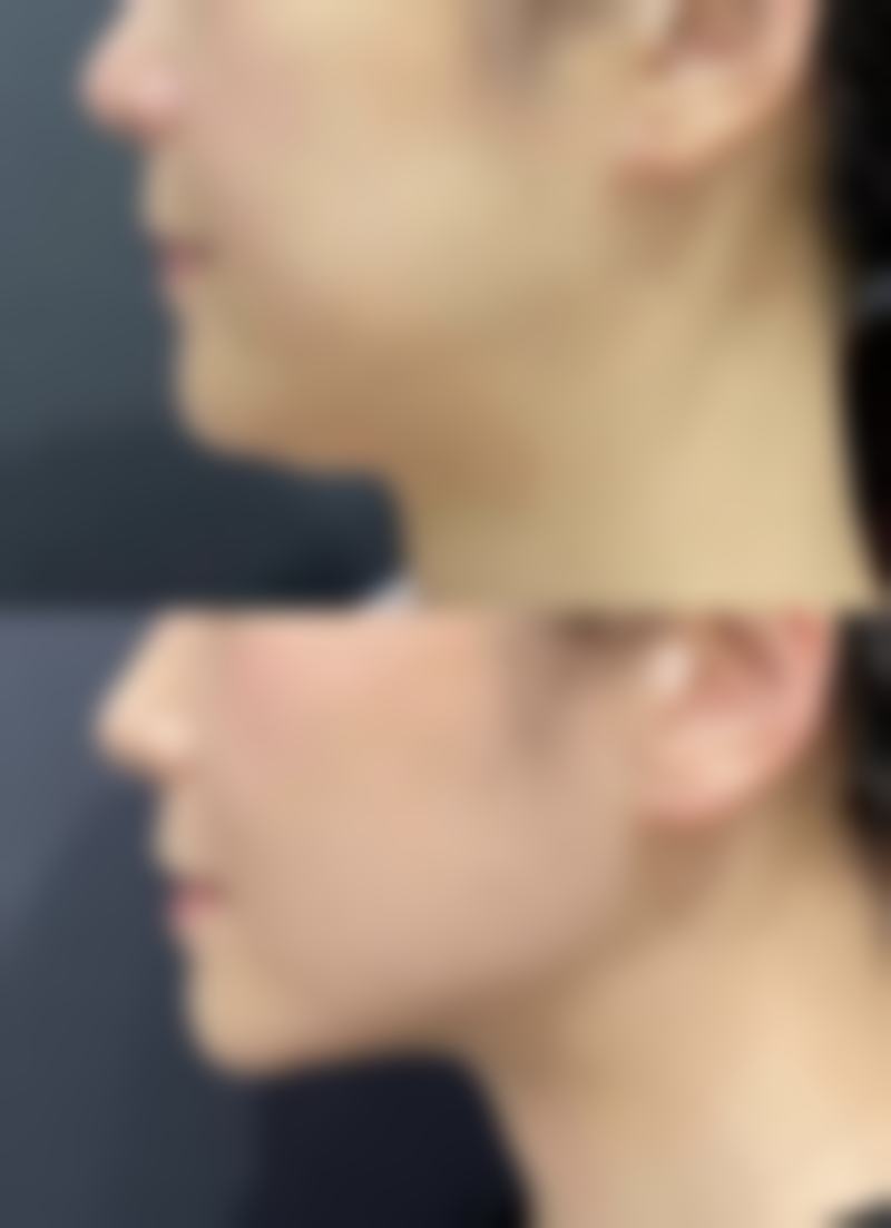 陈善闻患者评价