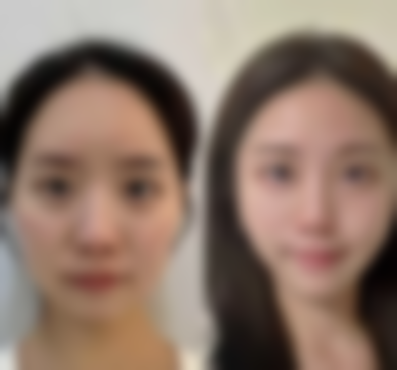 表参道Skin广岛核心项目