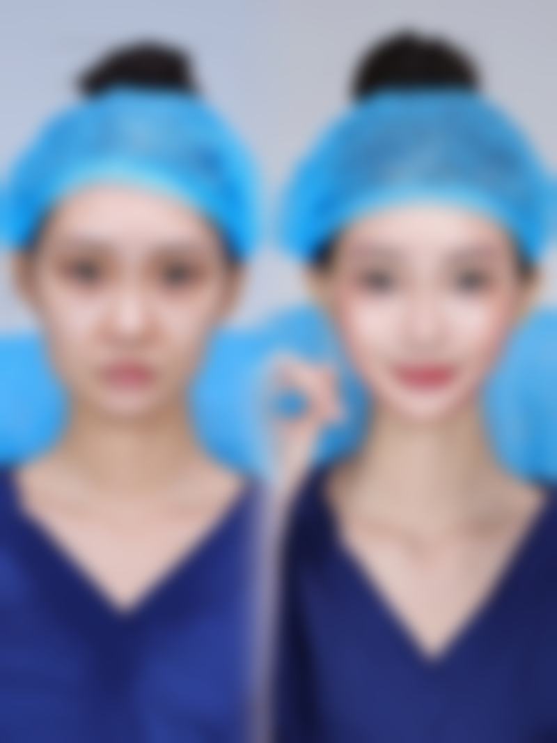 胡瑞铭患者评价