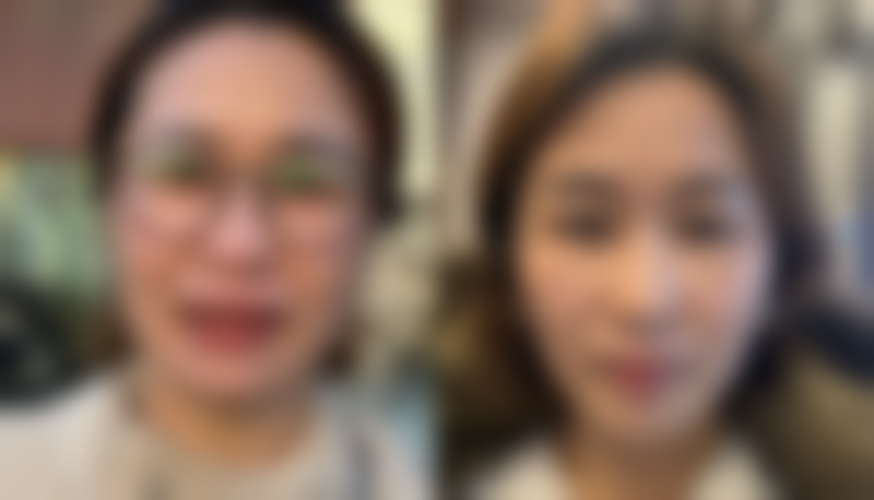 陈海黎擅长项目列表