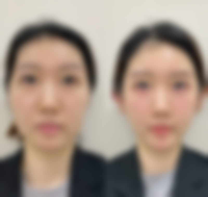 AGA皮肤科浜松核心项目