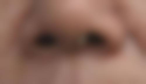 厦门174医院整形美容科核心项目