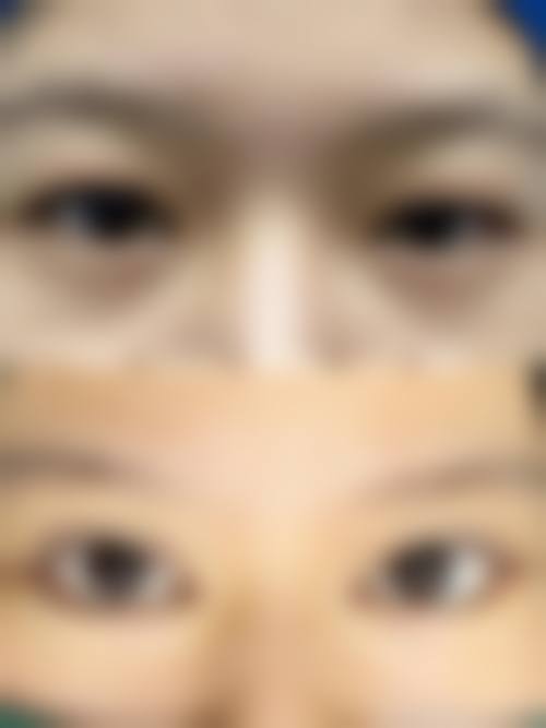 韩国美姿整形外科医院实例参考