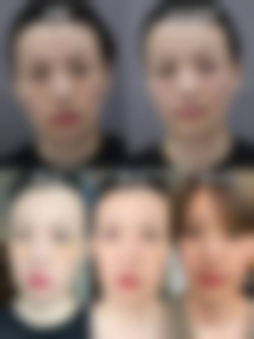 重庆悦然尚熙台整形医院核心项目