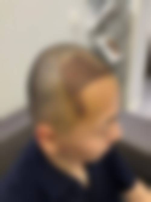 武汉曙光植发医生团队