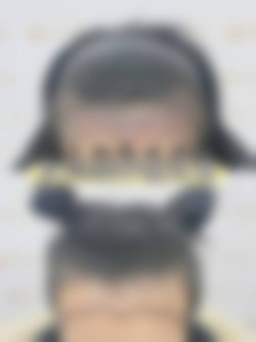 武汉曙光植发正规吗？看资质