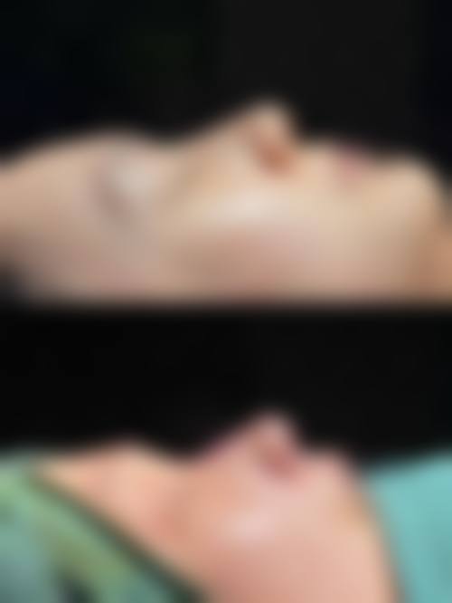 广州伊妍整形医院实例参考