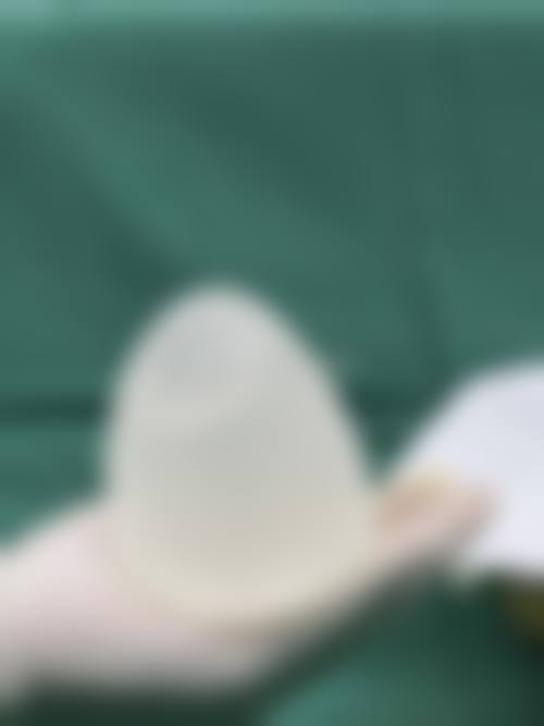 长春韩合爱心美容医院实例参考