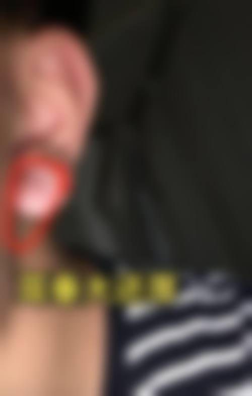 台湾首挑时尚医美诊所整形实例参考