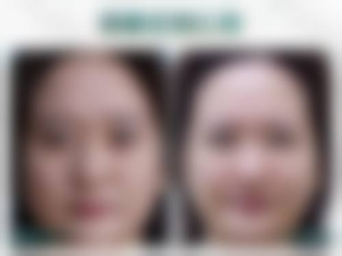 太原美雅枫整形美容门诊部核心项目