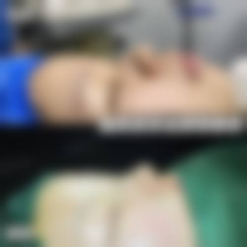 王旭冰预约方式