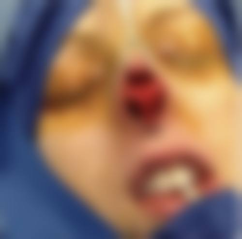 内蒙古杰琳医疗美容诊所价格表(仅供参考)