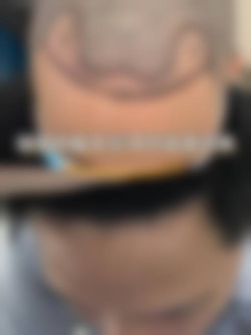 成都青羊和和至美医疗美容门诊部实例参考