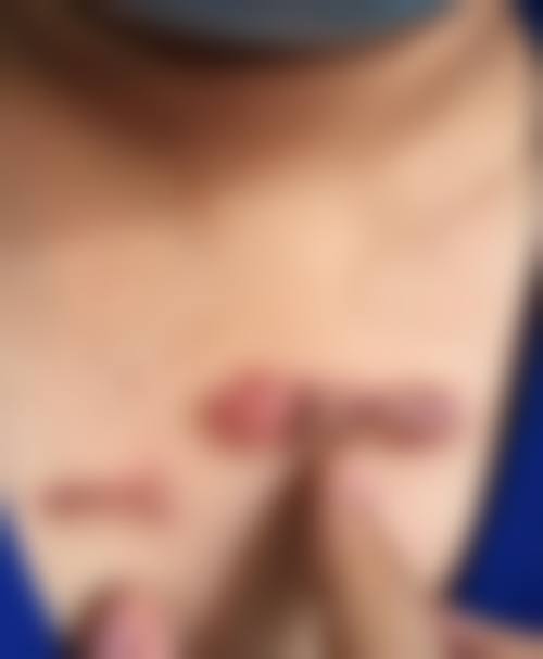 나누리神经外科核心项目