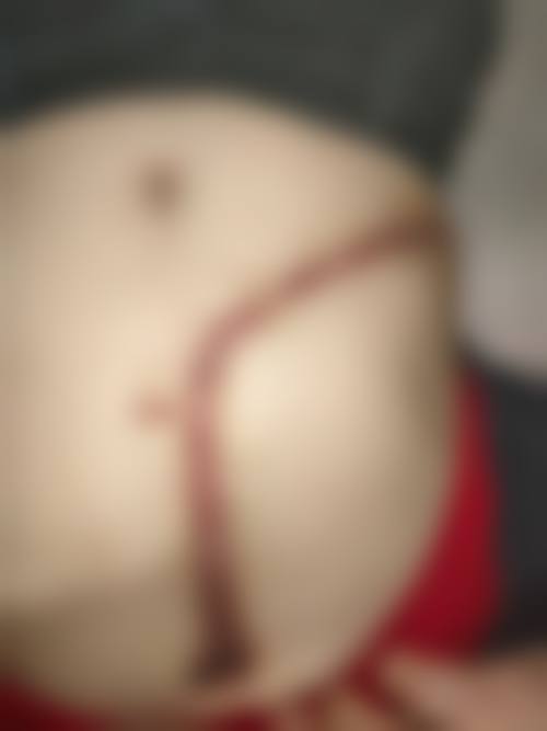 나누리神经外科怎么预约?