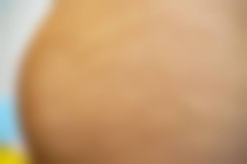 温州东方整形医疗美容医院实例参考