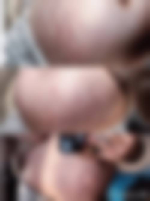 温州东方整形医疗美容医院怎么预约?