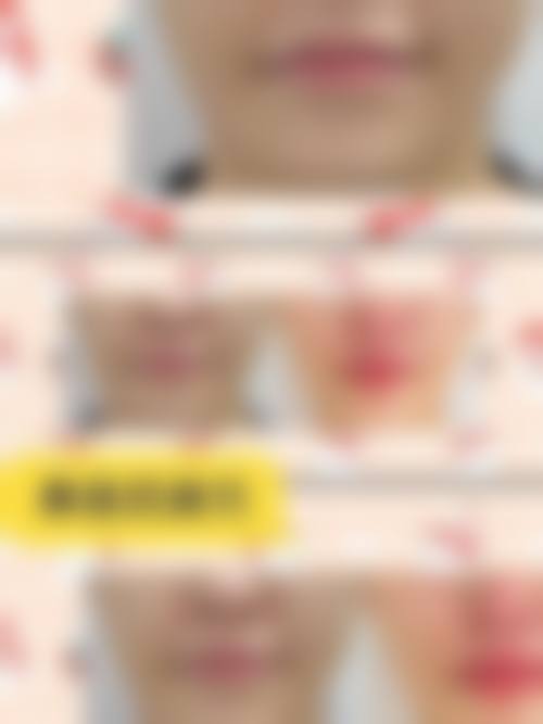 南昌媛颂医疗美容诊所核心项目