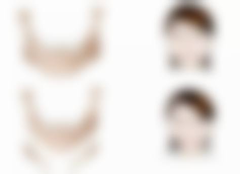 张格彰患者评价