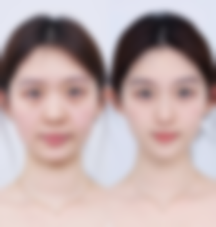 邯郸凯润婷医疗美容医院怎么预约？