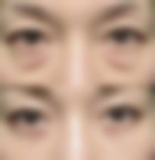 昆山时光整形医疗美容门诊部实例参考