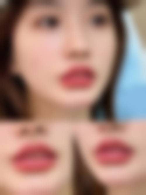 睢宁圣蓉医疗美容诊所怎么预约？