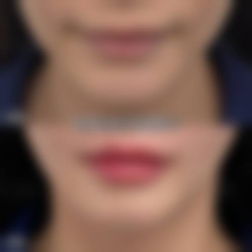 上海酥颜整形医院核心项目