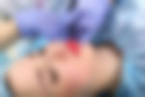 上海酥颜整形医院实例参考