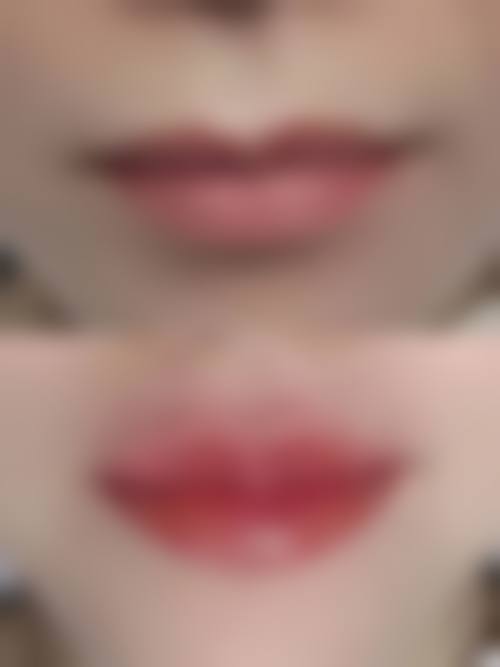 睢宁圣蓉医疗美容诊所核心项目