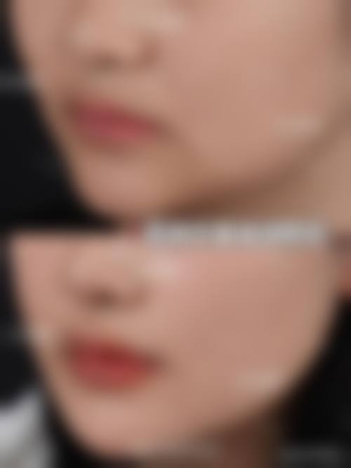 上海酥颜整形医院怎么预约?