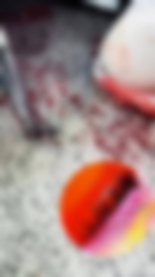 渭南师院附属医院医学美容科实例参考