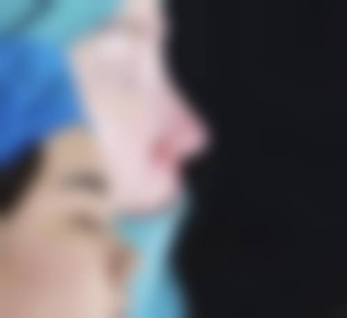 成都正好整形医院怎么预约？