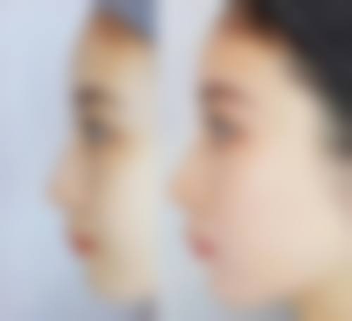 沈阳孟强(腾采)医疗美容诊所价格表(仅供参考)