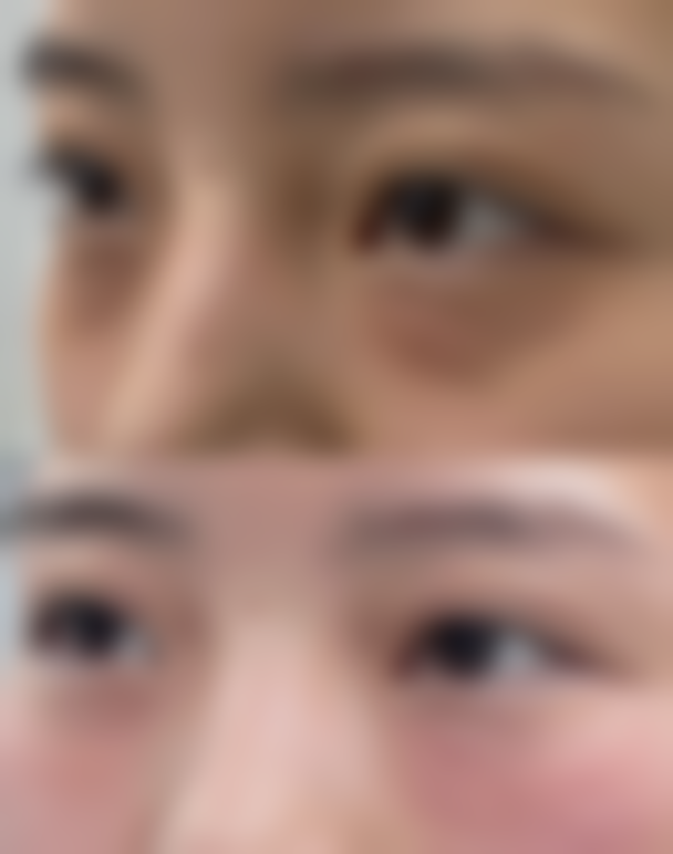 合肥蝶之星医疗美容价格表(仅供参考)